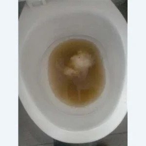 Toilet inlet valve for running toilet and cistern repair support